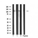 AF5182 staining Hela by IF/ICC. The samples were fixed with PFA and permeabilized in 0.1% Triton X-100,then blocked in 10% serum for 45 minutes at 25¡ãC. Samples were then incubated with primary Ab(AF5182 1:200) and mouse anti-beta tubulin Ab(T0023 1:200) for 1 hour at 37¡ãC. An  AlexaFluor594 conjugated goat anti-rabbit IgG(H+L) Ab(S0006 1:200 Red) and an AlexaFluor488 conjugated goat anti-mouse IgG(H+L) Ab(S0017 1:600 Green) were used as the secondary antibod