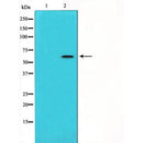Western blot analysis of extracts from Mouse brain, using Angiopoietin 1 Antibody. The lane on the left was treated with blocking peptide.