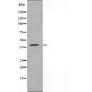 AF5188 staining Hela by IF/ICC. The samples were fixed with PFA and permeabilized in 0.1% Triton X-100,then blocked in 10% serum for 45 minutes at 25¡ãC. Samples were then incubated with primary Ab(AF5188 1:200) and mouse anti-beta tubulin Ab(T0023 1:200) for 1 hour at 37¡ãC. An  AlexaFluor594 conjugated goat anti-rabbit IgG(H+L) Ab(S0006 1:200 Red) and an AlexaFluor488 conjugated goat anti-mouse IgG(H+L) Ab(S0017 1:600 Green) were used as the secondary antibod
