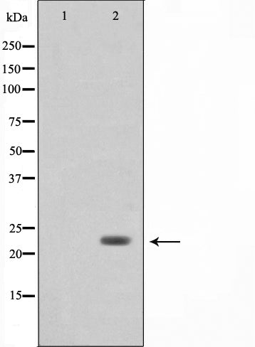 Western blot analysis on 293 cell lysate using Bak Antibody,The lane on the left is treated with the antigen-specific peptide.