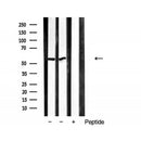 AF5210 staining Hela by IF/ICC. The samples were fixed with PFA and permeabilized in 0.1% Triton X-100,then blocked in 10% serum for 45 minutes at 25¡ãC. Samples were then incubated with primary Ab(AF5210 1:200) and mouse anti-beta tubulin Ab(T0023 1:200) for 1 hour at 37¡ãC. An  AlexaFluor594 conjugated goat anti-rabbit IgG(H+L) Ab(S0006 1:200 Red) and an AlexaFluor488 conjugated goat anti-mouse IgG(H+L) Ab(S0017 1:600 Green) were used as the secondary antibod