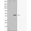 AF5219 staining LOVO cells by ICC/IF. Cells were fixed with PFA and permeabilized in 0.1% saponin prior to blocking in 10% serum for 45 minutes at 37¡ãC. The primary antibody was diluted 1/400 and incubated with the sample for 1 hour at 37¡ãC. A  Alexa Fluor? 594 conjugated goat polyclonal to rabbit IgG (H+L), diluted 1/600 was used as secondary antibod