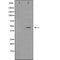 Western blot analysis of extracts from B16F10, using P47 Antibody. The lane on the left was treated with blocking peptide.