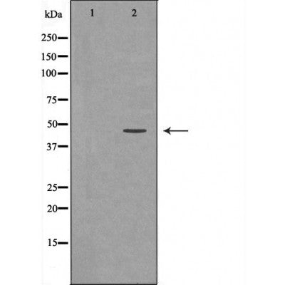 Western blot analysis of extracts from B16F10, using P47 Antibody. The lane on the left was treated with blocking peptide.