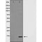 Western blot analysis of INSL3 expression in MCF7 cells,The lane on the left is treated with the antigen-specific peptide.
