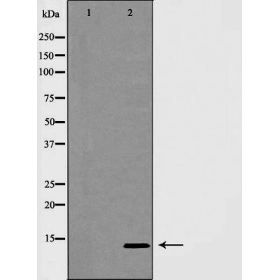 Western blot analysis of INSL3 expression in MCF7 cells,The lane on the left is treated with the antigen-specific peptide.