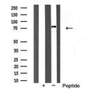 Western blot analysis of extracts from HepG2, using hnRNP Q Antibody. The lane on the left was treated with blocking peptide.