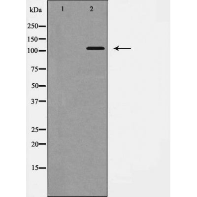 Western blot analysis of EPHB1 expression in COS7 cells,The lane on the left is treated with the antigen-specific peptide.