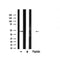 AF5241 staining Hela by IF/ICC. The samples were fixed with PFA and permeabilized in 0.1% Triton X-100,then blocked in 10% serum for 45 minutes at 25¡ãC. Samples were then incubated with primary Ab(AF5241 1:200) and mouse anti-beta tubulin Ab(T0023 1:200) for 1 hour at 37¡ãC. An  AlexaFluor594 conjugated goat anti-rabbit IgG(H+L) Ab(S0006 1:200 Red) and an AlexaFluor488 conjugated goat anti-mouse IgG(H+L) Ab(S0017 1:600 Green) were used as the secondary antibod