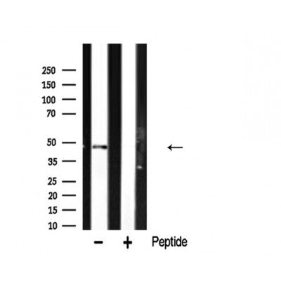 AF5241 staining Hela by IF/ICC. The samples were fixed with PFA and permeabilized in 0.1% Triton X-100,then blocked in 10% serum for 45 minutes at 25¡ãC. Samples were then incubated with primary Ab(AF5241 1:200) and mouse anti-beta tubulin Ab(T0023 1:200) for 1 hour at 37¡ãC. An  AlexaFluor594 conjugated goat anti-rabbit IgG(H+L) Ab(S0006 1:200 Red) and an AlexaFluor488 conjugated goat anti-mouse IgG(H+L) Ab(S0017 1:600 Green) were used as the secondary antibod