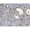 AF5244 staining Hela by IF/ICC. The samples were fixed with PFA and permeabilized in 0.1% Triton X-100,then blocked in 10% serum for 45 minutes at 25¡ãC. Samples were then incubated with primary Ab(AF5244 1:200) and mouse anti-beta tubulin Ab(T0023 1:200) for 1 hour at 37¡ãC. An  AlexaFluor594 conjugated goat anti-rabbit IgG(H+L) Ab(S0006 1:200 Red) and an AlexaFluor488 conjugated goat anti-mouse IgG(H+L) Ab(S0017 1:600 Green) were used as the secondary antibod