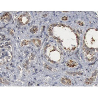 AF5244 staining Hela by IF/ICC. The samples were fixed with PFA and permeabilized in 0.1% Triton X-100,then blocked in 10% serum for 45 minutes at 25¡ãC. Samples were then incubated with primary Ab(AF5244 1:200) and mouse anti-beta tubulin Ab(T0023 1:200) for 1 hour at 37¡ãC. An  AlexaFluor594 conjugated goat anti-rabbit IgG(H+L) Ab(S0006 1:200 Red) and an AlexaFluor488 conjugated goat anti-mouse IgG(H+L) Ab(S0017 1:600 Green) were used as the secondary antibod