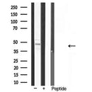 Western blot analysis of extracts from various samples, using GATA4 Antibody.
 Lane 1: Rat brain treated with blocking peptide;
 Lane 2: Rat brain;
 Lane 3: Rat kidney;
 Lane 4: Rat spleen;
 Lane 5: Rat liver.