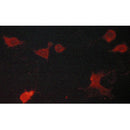 AF5248 staining Hela by IF/ICC. The samples were fixed with PFA and permeabilized in 0.1% Triton X-100,then blocked in 10% serum for 45 minutes at 25¡ãC. Samples were then incubated with primary Ab(AF5248 1:200) and mouse anti-beta tubulin Ab(T0023 1:200) for 1 hour at 37¡ãC. An  AlexaFluor594 conjugated goat anti-rabbit IgG(H+L) Ab(S0006 1:200 Red) and an AlexaFluor488 conjugated goat anti-mouse IgG(H+L) Ab(S0017 1:600 Green) were used as the secondary antibod