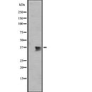 AF5252 staining Hela by IF/ICC. The samples were fixed with PFA and permeabilized in 0.1% Triton X-100,then blocked in 10% serum for 45 minutes at 25¡ãC. Samples were then incubated with primary Ab(AF5252 1:200) and mouse anti-beta tubulin Ab(T0023 1:200) for 1 hour at 37¡ãC. An  AlexaFluor594 conjugated goat anti-rabbit IgG(H+L) Ab(S0006 1:200 Red) and an AlexaFluor488 conjugated goat anti-mouse IgG(H+L) Ab(S0017 1:600 Green) were used as the secondary antibod