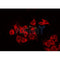AF5253 staining HepG2 by IF/ICC. The samples were fixed with PFA and permeabilized in 0.1% Triton X-100,then blocked in 10% serum for 45 minutes at 25¡ãC. Samples were then incubated with primary Ab(AF5253 1:200) and mouse anti-beta tubulin Ab(T0023 1:200) for 1 hour at 37¡ãC. An  AlexaFluor594 conjugated goat anti-rabbit IgG(H+L) Ab(S0006 1:200 Red) and an AlexaFluor488 conjugated goat anti-mouse IgG(H+L) Ab(S0017 1:600 Green) were used as the secondary antibod