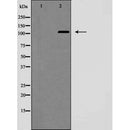 Western blot analysis of NOTCH2 (Cleaved-Ala1734) expression in Jurkat cells, treated with etoposide,The lane on the left is treated with the antigen-specific peptide.