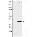 AF5261 staining HepG2 by IF/ICC. The samples were fixed with PFA and permeabilized in 0.1% Triton X-100,then blocked in 10% serum for 45 minutes at 25¡ãC. Samples were then incubated with primary Ab(AF5261 1:200) and mouse anti-beta tubulin Ab(T0023 1:200) for 1 hour at 37¡ãC. An  AlexaFluor594 conjugated goat anti-rabbit IgG(H+L) Ab(S0006 1:200 Red) and an AlexaFluor488 conjugated goat anti-mouse IgG(H+L) Ab(S0017 1:600 Green) were used as the secondary antibod