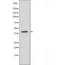 Western blot analysis of extracts from various samples, using hnRNP G Antibody.
 Lane 1: 293 treated with blocking peptide;
 Lane 2: 293;
 Lane 3: Hela.