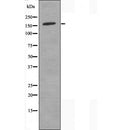 Western blot analysis of extracts from Rat spleen, using Collagen IV  alpha 2 Antibody. The lane on the left was treated with blocking peptide.