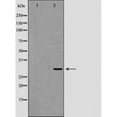 AF5265 staining HuvEC by IF/ICC. The sample were fixed with PFA and permeabilized in 0.1% Triton X-100,then blocked in 10% serum for 45 minutes at 25¡ãC. The primary antibody was diluted at 1/200 and incubated with the sample for 1 hour at 37¡ãC. An  Alexa Fluor 594 conjugated goat anti-rabbit IgG (H+L) Ab, diluted at 1/600, was used as the secondary antibod
