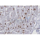 AF5266 staining HepG2 by IF/ICC. The samples were fixed with PFA and permeabilized in 0.1% Triton X-100,then blocked in 10% serum for 45 minutes at 25¡ãC. Samples were then incubated with primary Ab(AF5266 1:200) and mouse anti-beta tubulin Ab(T0023 1:200) for 1 hour at 37¡ãC. An  AlexaFluor594 conjugated goat anti-rabbit IgG(H+L) Ab(S0006 1:200 Red) and an AlexaFluor488 conjugated goat anti-mouse IgG(H+L) Ab(S0017 1:600 Green) were used as the secondary antibod