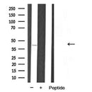 AF5268 staining HepG2 by IF/ICC. The samples were fixed with PFA and permeabilized in 0.1% Triton X-100,then blocked in 10% serum for 45 minutes at 25¡ãC. Samples were then incubated with primary Ab(AF5268 1:200) and mouse anti-beta tubulin Ab(T0023 1:200) for 1 hour at 37¡ãC. An  AlexaFluor594 conjugated goat anti-rabbit IgG(H+L) Ab(S0006 1:200 Red) and an AlexaFluor488 conjugated goat anti-mouse IgG(H+L) Ab(S0017 1:600 Green) were used as the secondary antibod