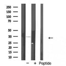 Western blot analysis of AQP12 expression in Jurkat cells