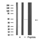 Western blot analysis of extracts from various samples, using GATA6 Antibody.
 Lane 1: HepG2 treated with blocking peptide;
 Lane 2: HepG2;
 Lane 3: Mouse  brain.