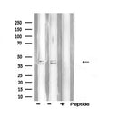 AF5272 staining HepG2 by IF/ICC. The sample were fixed with PFA and permeabilized in 0.1% Triton X-100,then blocked in 10% serum for 45 minutes at 25¡ãC. The primary antibody was diluted at 1/200 and incubated with the sample for 1 hour at 37¡ãC. An  Alexa Fluor 594 conjugated goat anti-rabbit IgG (H+L) Ab, diluted at 1/600, was used as the secondary antibod