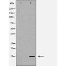 AF5273 staining MCF-7 cells by IF/ICC. The sample were fixed with PFA and permeabilized in 0.1% Triton X-100,then blocked in 10% serum for 45 minutes at 25¡ãC. The primary antibody was diluted at 1/200 and incubated with the sample for 1 hour at 37¡ãC. An  Alexa Fluor 594 conjugated goat anti-rabbit IgG (H+L) antibody(Cat.