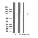 AF5274 staining HepG2 by IF/ICC. The sample were fixed with PFA and permeabilized in 0.1% Triton X-100,then blocked in 10% serum for 45 minutes at 25¡ãC. The primary antibody was diluted at 1/200 and incubated with the sample for 1 hour at 37¡ãC. An  Alexa Fluor 594 conjugated goat anti-rabbit IgG (H+L) Ab, diluted at 1/600, was used as the secondary antibod