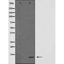 AF5277 staining HepG2 by IF/ICC. The samples were fixed with PFA and permeabilized in 0.1% Triton X-100,then blocked in 10% serum for 45 minutes at 25¡ãC. Samples were then incubated with primary Ab(AF5277 1:200) and mouse anti-beta tubulin Ab(T0023 1:200) for 1 hour at 37¡ãC. An  AlexaFluor594 conjugated goat anti-rabbit IgG(H+L) Ab(S0006 1:200 Red) and an AlexaFluor488 conjugated goat anti-mouse IgG(H+L) Ab(S0017 1:600 Green) were used as the secondary antibod