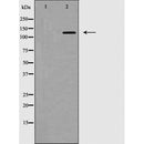 AF5278 staining HepG2 by IF/ICC. The sample were fixed with PFA and permeabilized in 0.1% Triton X-100,then blocked in 10% serum for 45 minutes at 25¡ãC. The primary antibody was diluted at 1/200 and incubated with the sample for 1 hour at 37¡ãC. An  Alexa Fluor 594 conjugated goat anti-rabbit IgG (H+L) Ab, diluted at 1/600, was used as the secondary antibod