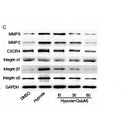 Western blot analysis of extracts from Hela, using CXCR4 Antibody. The lane on the left was treated with blocking peptide.