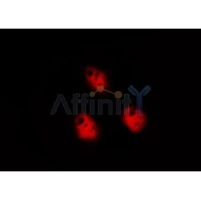 Western blot analysis of extracts from various samples, using CHOP Antibody.
 Lane 1: B16F10 treated with blocking peptide;
 Lane 2: B16F10;
 Lane 3: Rat  brain.