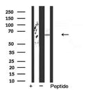 AF5282 staining HeLa by IF/ICC. The sample were fixed with PFA and permeabilized in 0.1% Triton X-100,then blocked in 10% serum for 45 minutes at 25¡ãC. The primary antibody was diluted at 1/200 and incubated with the sample for 1 hour at 37¡ãC. An  Alexa Fluor 594 conjugated goat anti-rabbit IgG (H+L) Ab, diluted at 1/600, was used as the secondary antibod