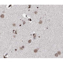 AF5284 staining HepG2 by IF/ICC. The sample were fixed with PFA and permeabilized in 0.1% Triton X-100,then blocked in 10% serum for 45 minutes at 25¡ãC. The primary antibody was diluted at 1/200 and incubated with the sample for 1 hour at 37¡ãC. An  Alexa Fluor 594 conjugated goat anti-rabbit IgG (H+L) Ab, diluted at 1/600, was used as the secondary antibod