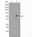 Western blot analysis of extracts from HepG2, using MEN1 Antibody. The lane on the left was treated with blocking peptide.