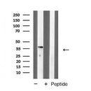 AF5286 at 1/100 staining Mouse pancreas tissue by IHC-P. The sample was formaldehyde fixed and a heat mediated antigen retrieval step in citrate buffer was performed. The sample was then blocked and incubated with the antibody for 1.5 hours at 22¡ãC. An HRP conjugated goat anti-rabbit antibody was used as the secondary