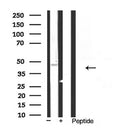 Western blot analysis of extracts from Hela, using Kir6.2 Antibody. The lane on the left was treated with blocking peptide.

Observed bands: 55 kDa.