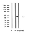 Western blot analysis of extracts from Hybridoma cells, using CMKLR1 Antibody. The lane on the left was treated with blocking peptide.