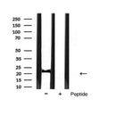 AF5292 at 1/200 staining human breast cancer tissue sections by IHC-P. The tissue was formaldehyde fixed and a heat mediated antigen retrieval step in citrate buffer was performed. The tissue was then blocked and incubated with the antibody for 1.5 hours at 22¡ãC. An HRP conjugated goat anti-rabbit antibody was used as the secondary