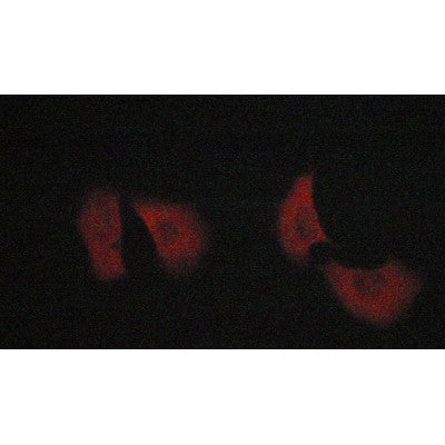 AF0120 staining lovo cells by ICC/IF. Cells were fixed with PFA and permeabilized in 0.1% saponin prior to blocking in 10% serum for 45 minutes at 37¡ãC. The primary antibody was diluted 1/400 and incubated with the sample for 1 hour at 37¡ãC. A  Alexa Fluor? 594 conjugated goat polyclonal to rabbit IgG (H+L), diluted 1/600 was used as secondary antibod