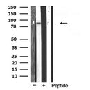 Western blot analysis of extracts from Hela, using ADAM10 Antibody. The lane on the left was treated with blocking peptide.

Observed bands: 55 kDa.