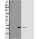 AF5295 at 1/100 staining Mouse brain tissue by IHC-P. The sample was formaldehyde fixed and a heat mediated antigen retrieval step in citrate buffer was performed. The sample was then blocked and incubated with the antibody for 1.5 hours at 22¡ãC. An HRP conjugated goat anti-rabbit antibody was used as the secondary