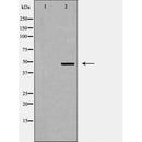 AF5297 staining NCI-H460 cells by IF/ICC. The sample were fixed with PFA and permeabilized in 0.1% Triton X-100,then blocked in 10% serum for 45 minutes at 25¡ãC. The primary antibody was diluted at 1/200 and incubated with the sample for 1 hour at 37¡ãC. An  Alexa Fluor 594 conjugated goat anti-rabbit IgG (H+L) antibody(Cat.