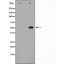 Western blot analysis of extracts from Hela, using NRF1 Antibody. The lane on the left was treated with blocking peptide.