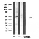 AF5299 staining HT29 by IF/ICC. The sample were fixed with PFA and permeabilized in 0.1% Triton X-100,then blocked in 10% serum for 45 minutes at 25¡ãC. The primary antibody was diluted at 1/200 and incubated with the sample for 1 hour at 37¡ãC. An  Alexa Fluor 594 conjugated goat anti-rabbit IgG (H+L) Ab, diluted at 1/600, was used as the secondary antibod