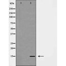Western blot analysis of LEG7 expression in HeLa cells.The lane on the left is treated with the antigen-specific peptide.